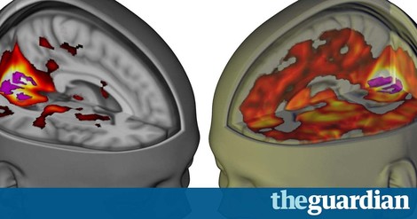 New Research On LSD: Insight On Treating Psychiatric Disorders And Understanding Consciousness