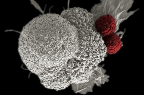 Listen Up Silicon Valley, Cancer Cure Ain't So Easy 