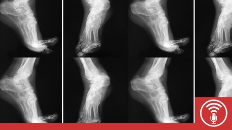 Podcast: A Short History Of Foot-Binding